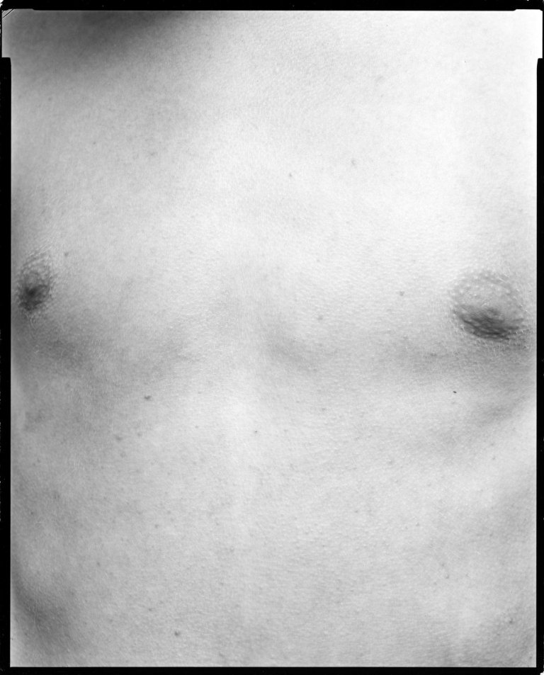 Auf diesem Bild ist das folgende Kunstwerk zu sehen: Nicholas Nixon. „Sam. Lexington“, aus der Serie „Family pictures“. 1998.