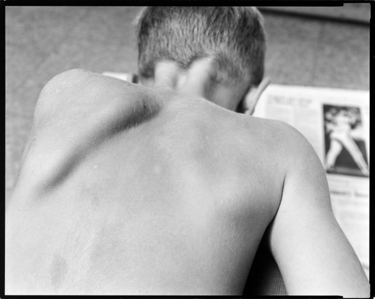 Auf diesem Bild ist das folgende Kunstwerk zu sehen: Nicholas Nixon. „Sam. Cambridge“, aus der Serie „Family pictures“. 1990.