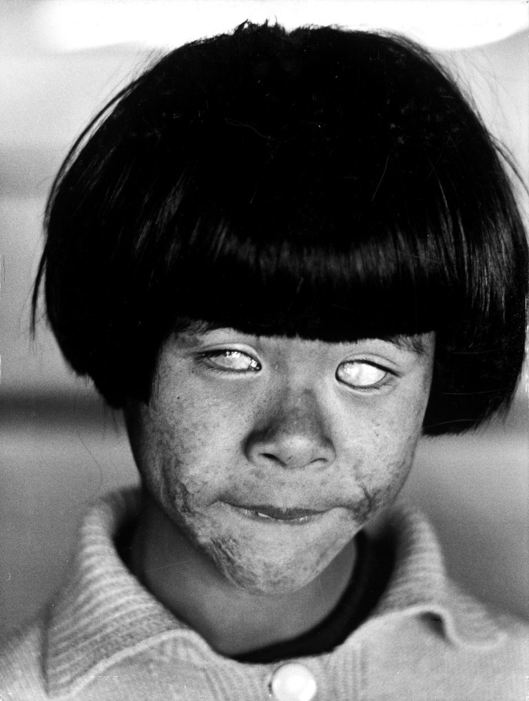 Auf diesem Bild ist das folgende Kunstwerk zu sehen: Christer Strömholm. „Hiroshima“. 1963.