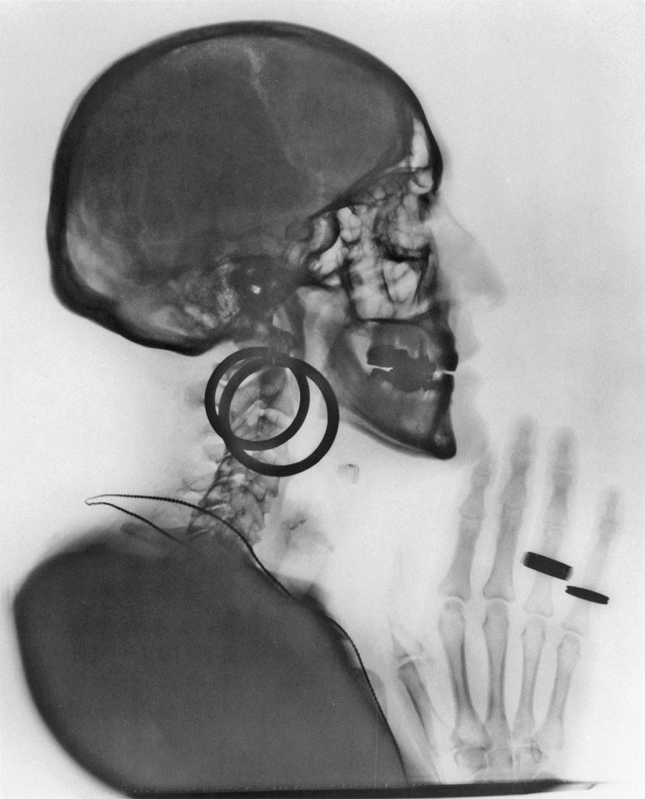 Auf diesem Bild ist das folgende Kunstwerk zu sehen: Meret Oppenheim. X-Ray. 1964.