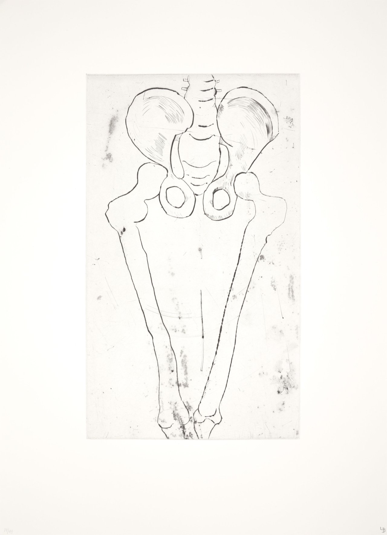 This picture shows the following artwork: Louise Bourgeois. ”Anatomy”. 1989/90.