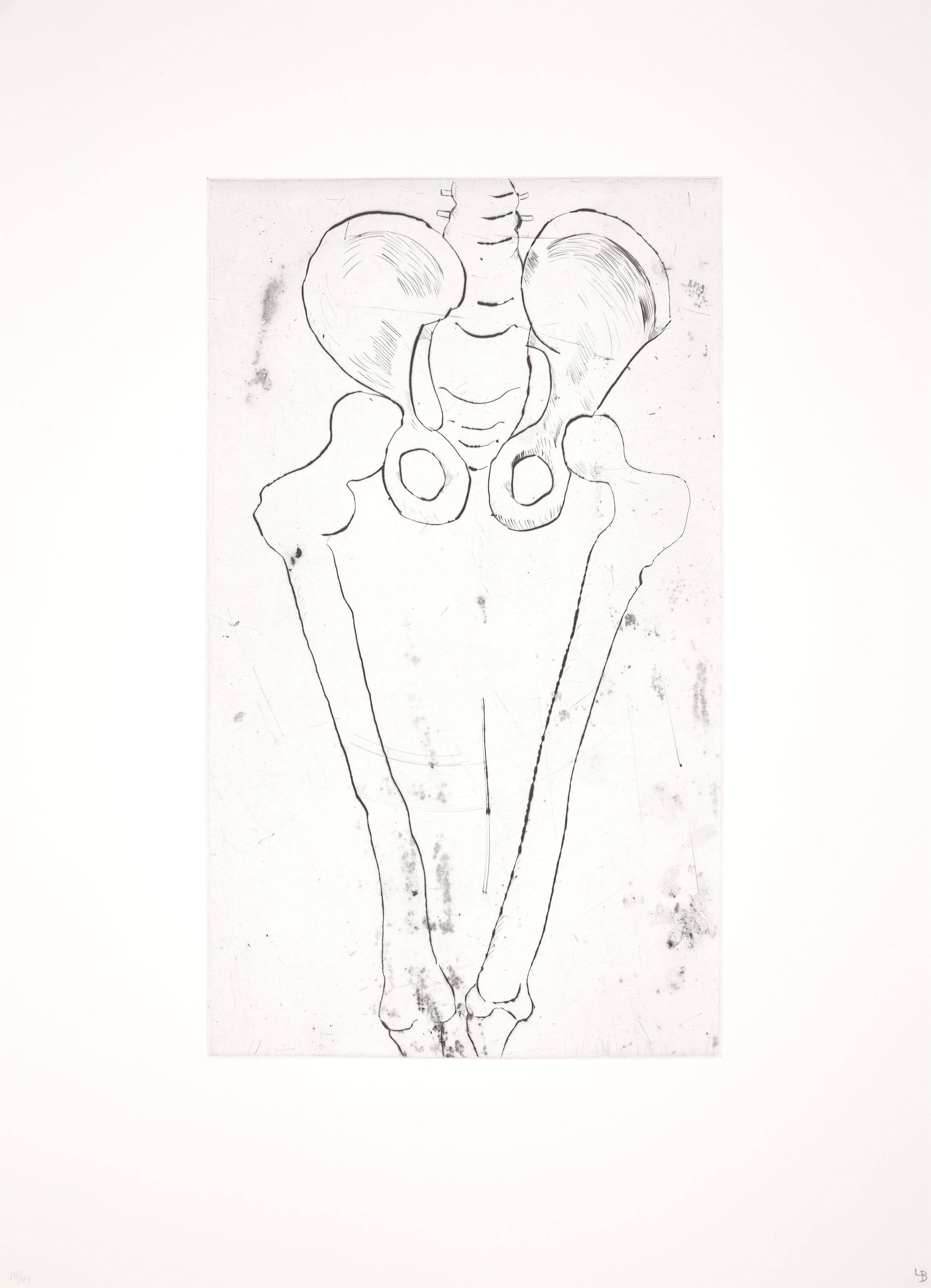 This picture shows the following artwork: Louise Bourgeois. ”Anatomy”. 1989/90.