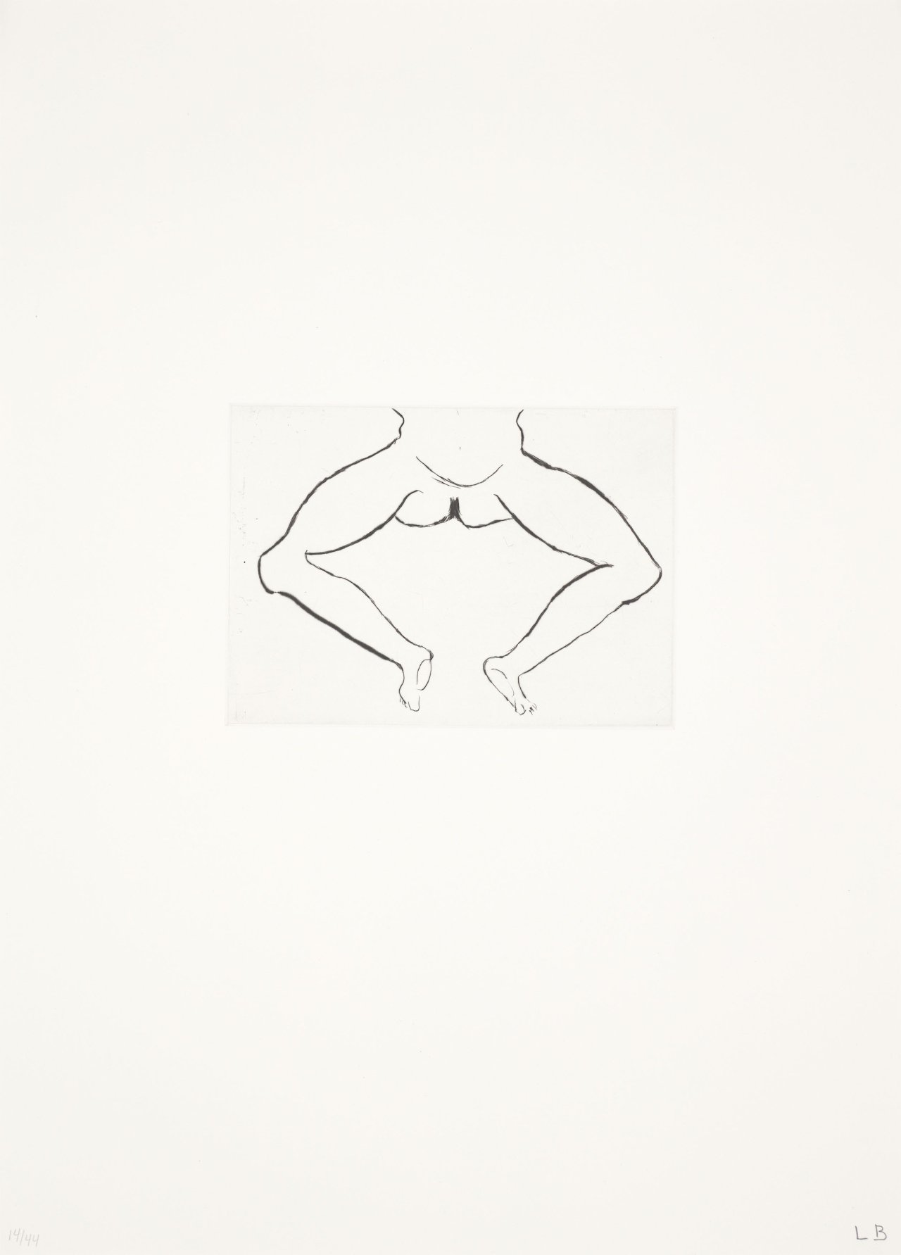 This picture shows the following artwork: Louise Bourgeois. ”Anatomy”. 1989/90.